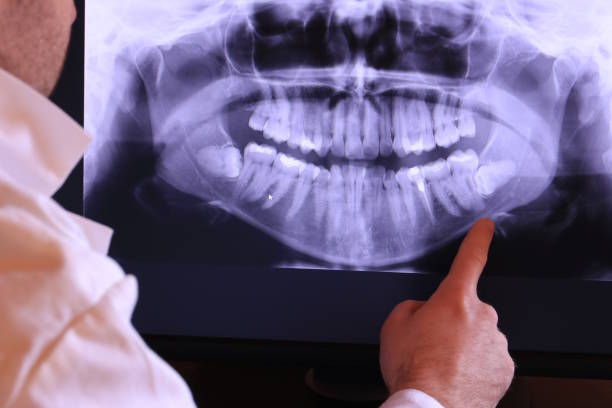 Best Holiday Emergency Dentist in Sparta, MI