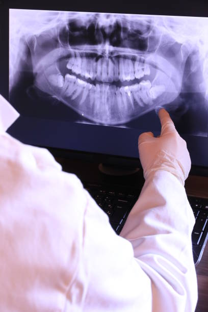 Best Emergency Dental Extractions in Sparta, MI